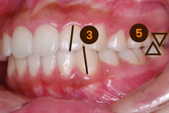 質の高い矯正治療の基準