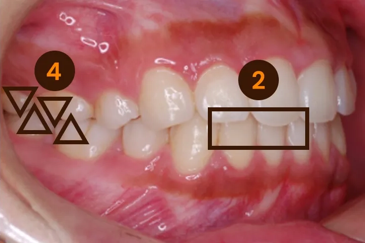 質の高い矯正治療の基準